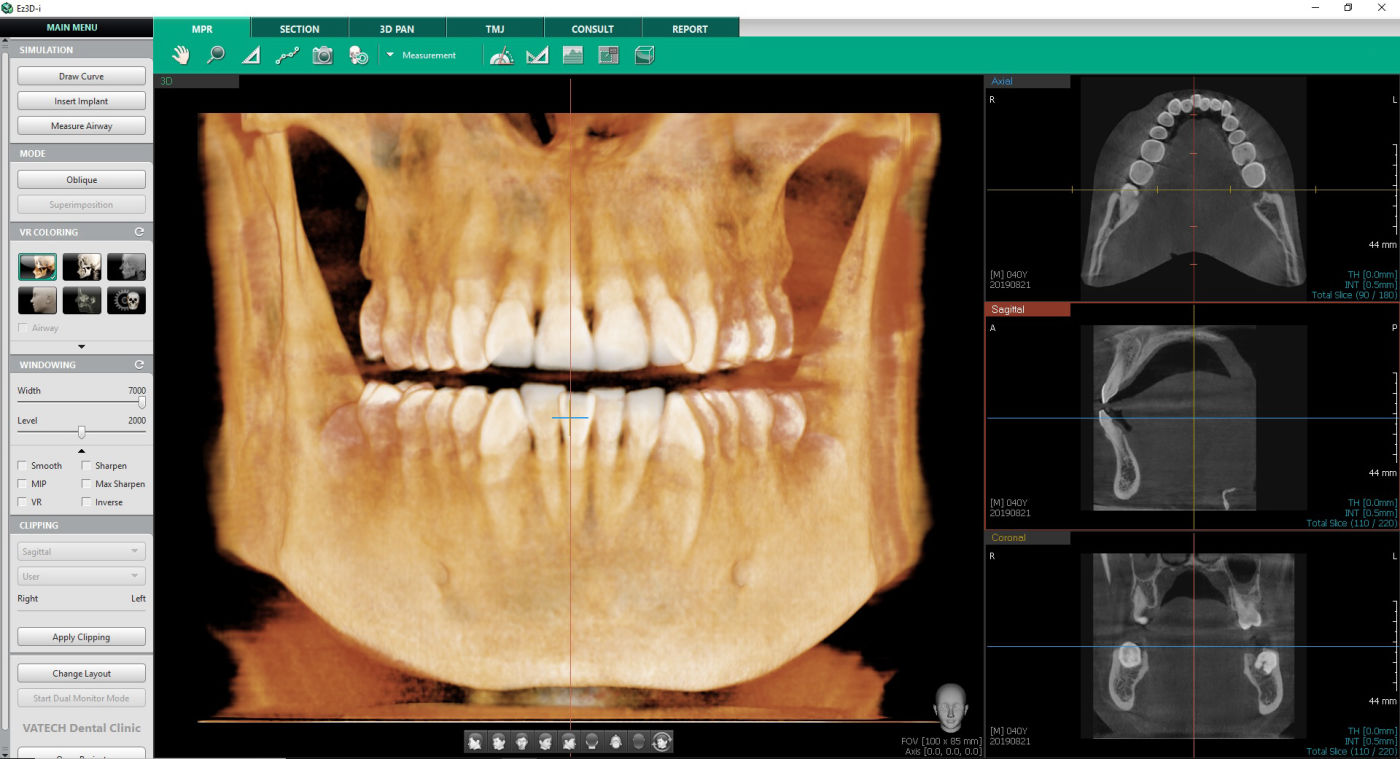 3D Para la planificación de un tratamiento